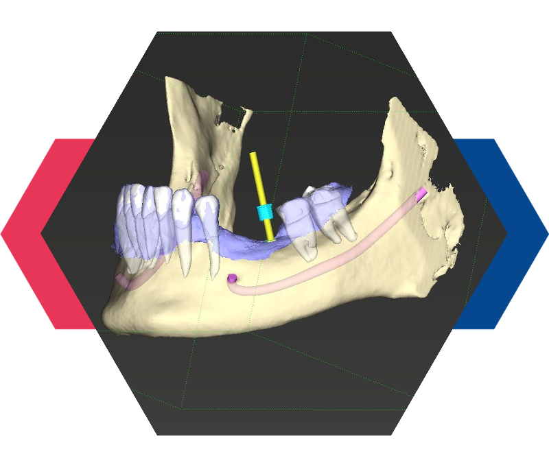 Scanner Intraorale Roma